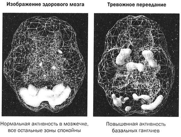 Мозг против лишнего веса