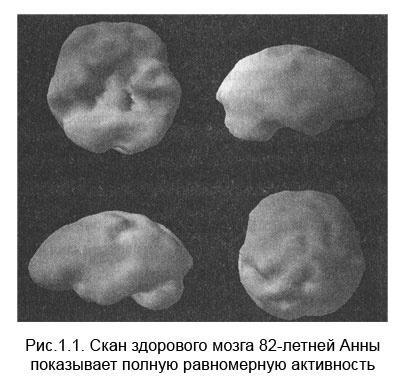 Измени свой мозг - изменится и тело!