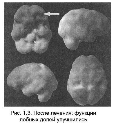 Измени свой мозг - изменится и тело!