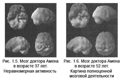 Измени свой мозг - изменится и тело!