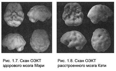 Измени свой мозг - изменится и тело!