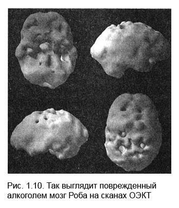 Измени свой мозг - изменится и тело!