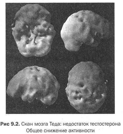 Измени свой мозг - изменится и тело!