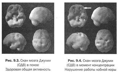 Измени свой мозг - изменится и тело!