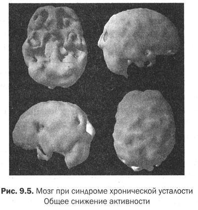 Измени свой мозг - изменится и тело!