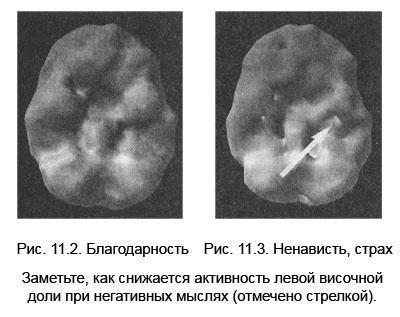 Измени свой мозг - изменится и тело!