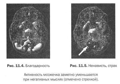 Измени свой мозг - изменится и тело!