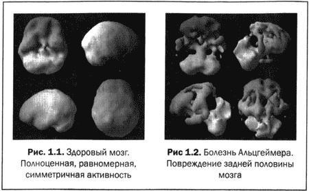 Великолепный мозг в любом возрасте