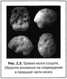 Великолепный мозг в любом возрасте