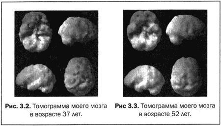 Великолепный мозг в любом возрасте