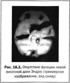 Великолепный мозг в любом возрасте