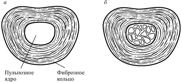 Здоровье вашего позвоночника