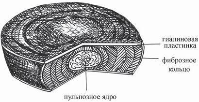 Остеохондроз для профессионального пациента