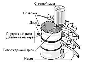 Мощная сила в борьбе с болезнями. Гомеопатия