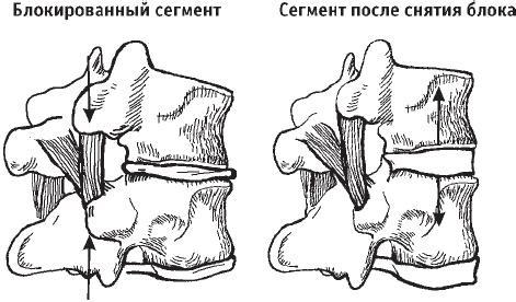 Первая скрипка позвоночника. Революционная методика лечения остеохондроза