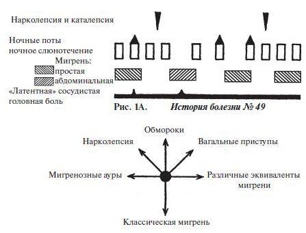 Мигрень