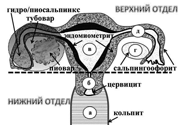 Бесплодие – не приговор!