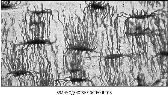 Йога при остеопорозе