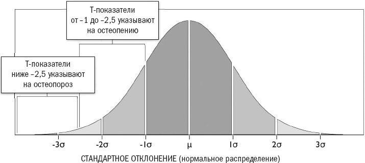 Йога при остеопорозе