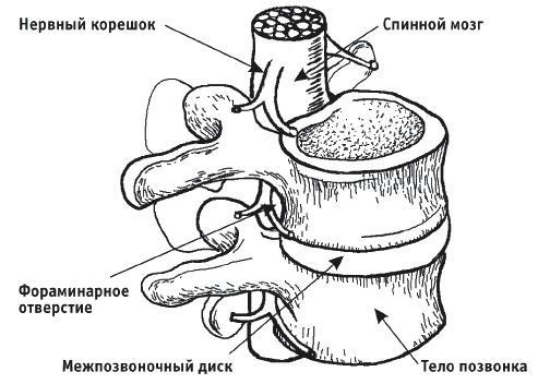 Грыжа позвоночника. Безоперационное лечение и профилактика