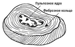 Грыжа позвоночника. Безоперационное лечение и профилактика