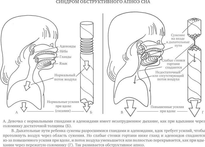 Сон ребенка. Решение всех проблем