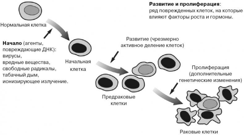 Антирак груди