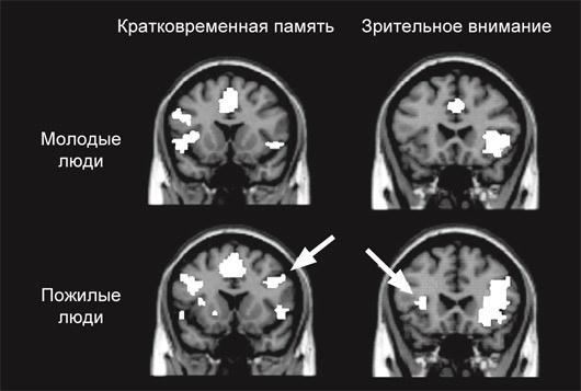 Мозг на пенсии. Научный взгляд на преклонный возраст