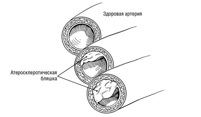 Здоровое сердце. Издание XXI века