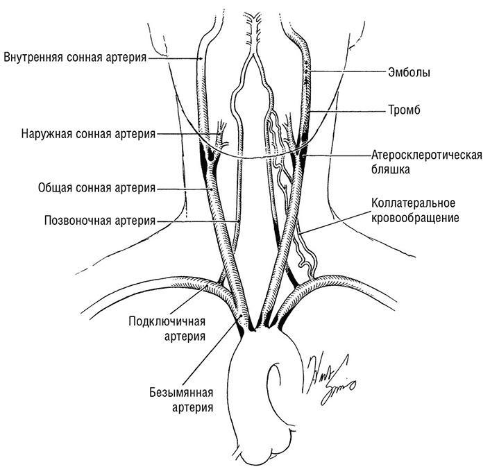 Здоровое сердце. Издание XXI века