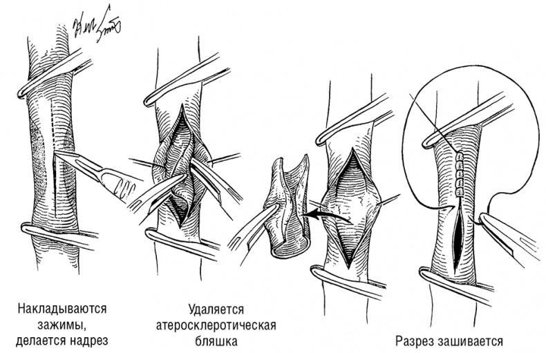 Здоровое сердце. Издание XXI века